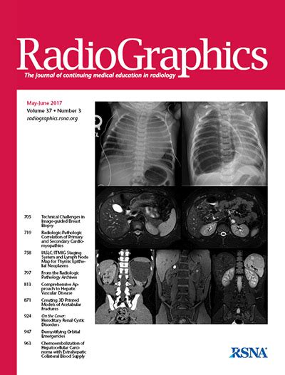 A Comprehensive Approach To Hepatic Vascular Disease Radiographics