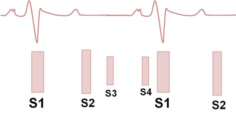 Img Ruidos Cardiacos Normales Tercer Y Cuarto Ruido Cardio Science