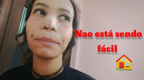 Vlog Alectomia O Nariz Operado Sa Mos A Procura De Uma Casa