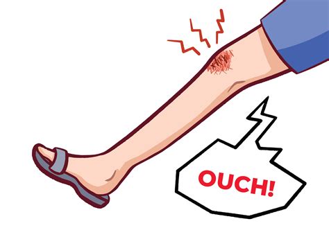 Grazed Or Wounded And Bleeding Knee Leg Vector Illustration Isolated On