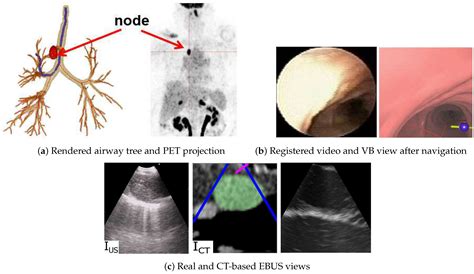 J Imaging Free Full Text Multimodal Registration For Image Guided