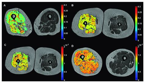 Examples Of Representative Color Coded Imaging Biomarkers Of The