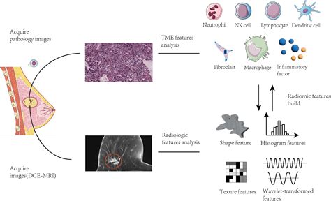 Radiomic Models Predict Tumor Microenvironment Using Artificial