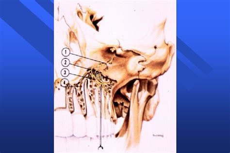 Middle Superior Alveolar Nerve Block Nerve Anesthetized Middle