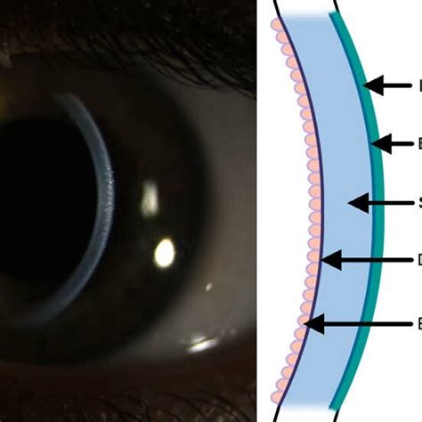 cornea location  anatomy  cornea   anterior refractive