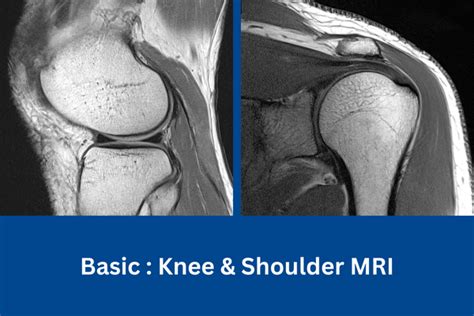 Basic Knee And Shoulder Mri Imaging