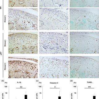 Immunohistochemical analysis of phosphorylated interleukin IL 1β and