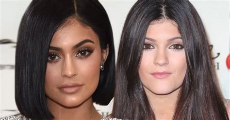 Kylie Jenner Hits Back At Claims She S Had Cheek And Jaw Surgery As Her