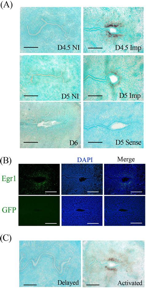 Spatiotemporal Expressions Of Egr1 MRNA And Protein In Mouse Uterus