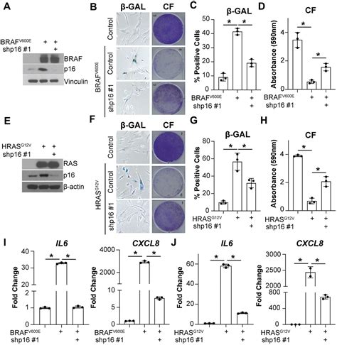 Suppression Of P16 Alleviates The Senescence Associated Secretory