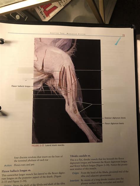 Lateral Shank Muscle Diagram Quizlet