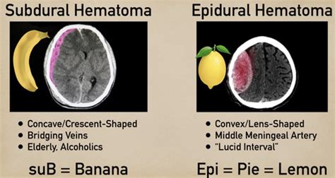 Neuro Emergencies Flashcards Quizlet