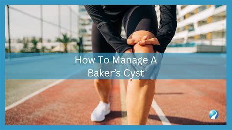 How To Manage A Baker S Cyst Mississauga Chiropractor And