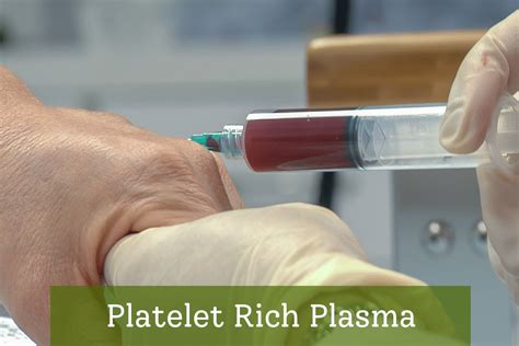 Platelet Rich Plasma For Your Body Goals Rainforest Med Spa