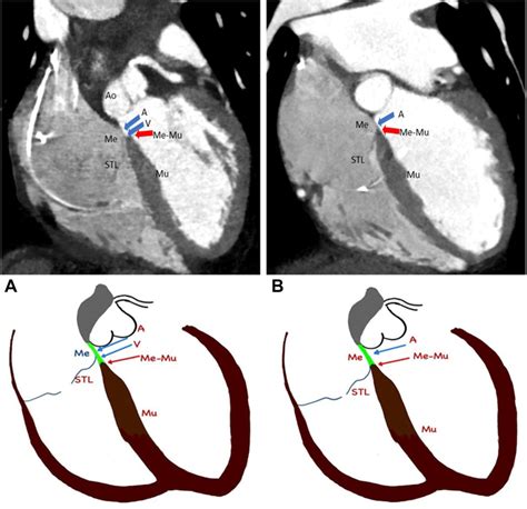 Relevant anatomy as seen in CT scan (see Appendix 3 for larger images ...