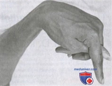 Физиология гипокальциемии. Гиперкальциемия в организме