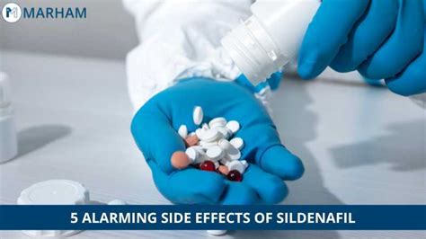 Sildenafil (Viagara) Side Effects - Sildenafil Tablet Price in Pakistan ...