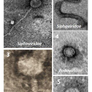 Electron micrographic visualization of three types of Erwinia amylovora ...