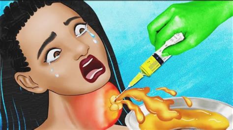 ASMR Get Rid Of Giant Acne On The Neck Cartoon Video Big Acne