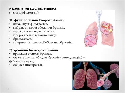Бронхообструктивний синдром - презентация онлайн