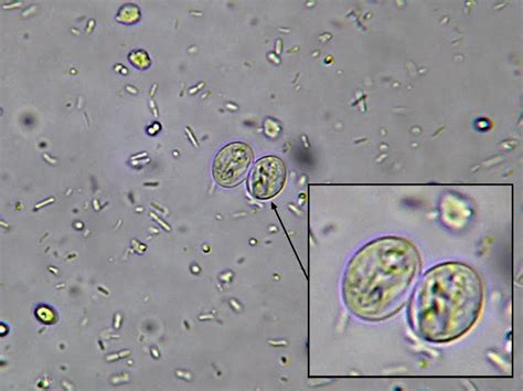 Giardia Cyst In Stool Hot Sex Picture