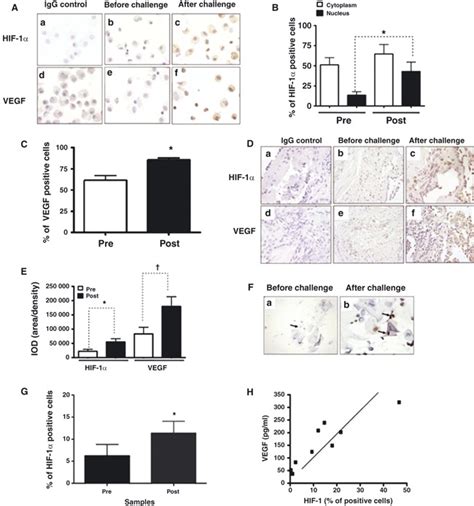 Enhanced Hypoxia Inducible Factor Hif And Vegf Expression In