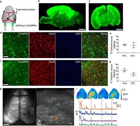 Simultaneous Mesoscopic And Two Photon Imaging Of Neuronal Activity In