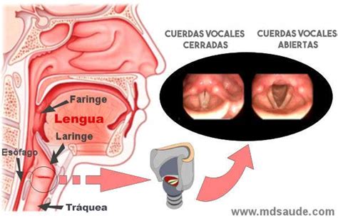 LARINGITIS Síntomas Causas y tratamiento MD Saúde