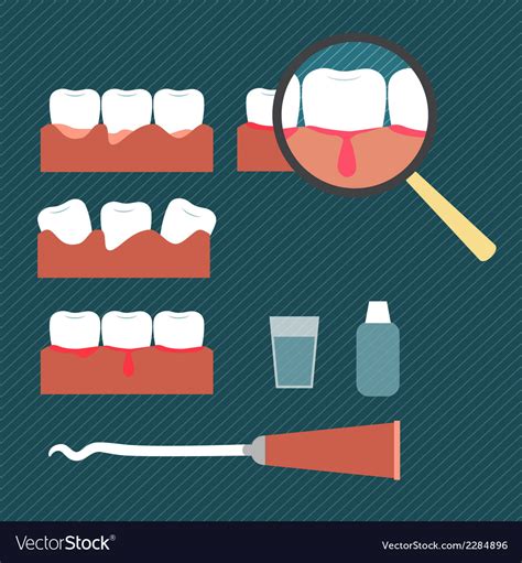 Showing gum disease Royalty Free Vector Image - VectorStock