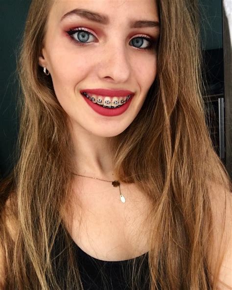 Braces Girl From Turning Red At Joshua Wydra Blog