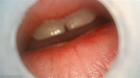 Burping Deep Throat Endoscopy 720 Wmv Strangecares Clips4sale