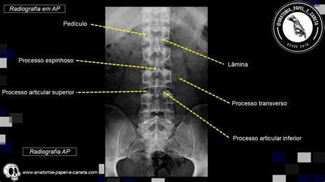 Anatomia Radiol Gica Da Coluna Vertebral Anatomia Papel E Caneta