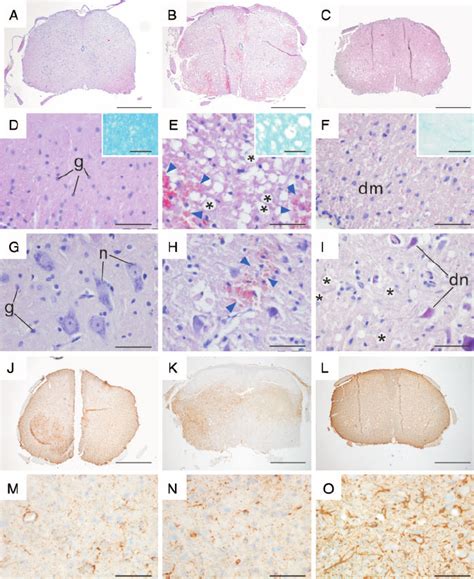 Spinal cord histology. Transverse sections at T6 from AQP4 +/+ mice.... | Download Scientific ...