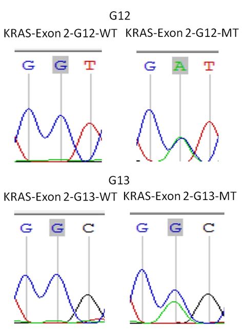 KRAS Exon 2 Primer Set FemtoPath HongJing弘晉