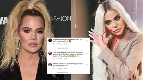 Khloe Kardashian Mocked After Sharing A Badly Photoshopped Image Featuring Two Thumbs On One