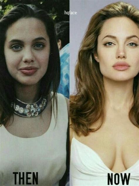 Did Angelina Jolie Ever Say Anything About Plastic Surgery Angelina