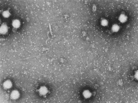 Fatal disease: Congo virus claims another life - The Express Tribune