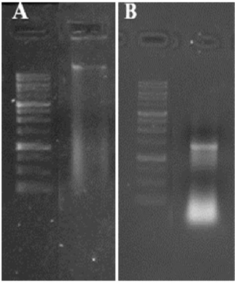 Agarose Gel Electrophoresis Image Of Amycolatopsis Sp Strain Mn235945