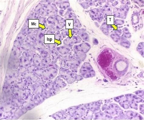 Parotid Gland Tissue Of Group B Affected By Cytoplasmic Vacuolization