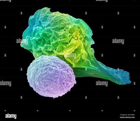 T Lymphocyte And Lymphoma Cancer Cell Coloured Scanning Electron