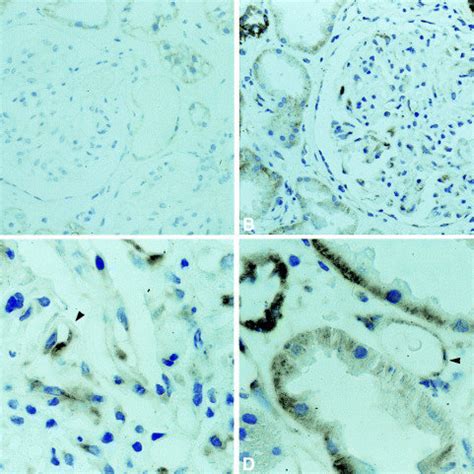 Bcl XL Staining A Photomicrograph Of A Section Taken From A Normal