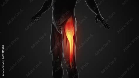 Pain and injury in the Tensor Fasciae Latae Muscles Stock Video | Adobe ...