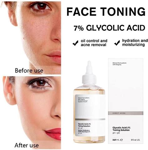 Glycolic Acid Before And After Photos