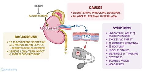 Pathology Conn Syndrome Kembara Xtra