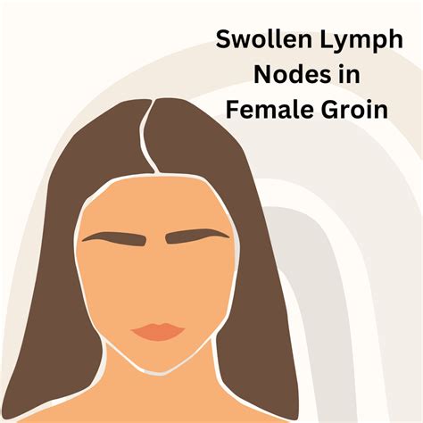 Swollen Lymph Nodes In Groin Female Pictures – NBKomputer