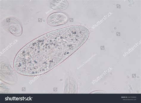 Protozoa Under Microscope Labeled