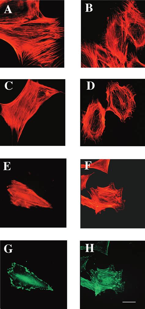 Sparc Null Mesangial Cells Exhibit An Altered Morphology In Comparison