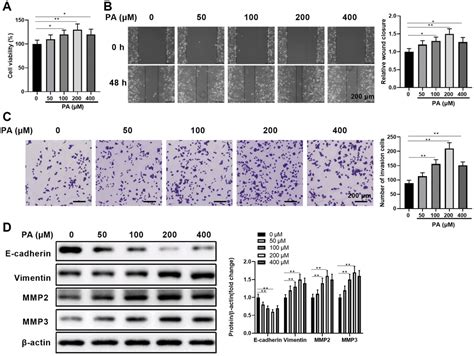 Palmitic Acid Promotes Human Retinal Pigment Epithelial Cells Migration