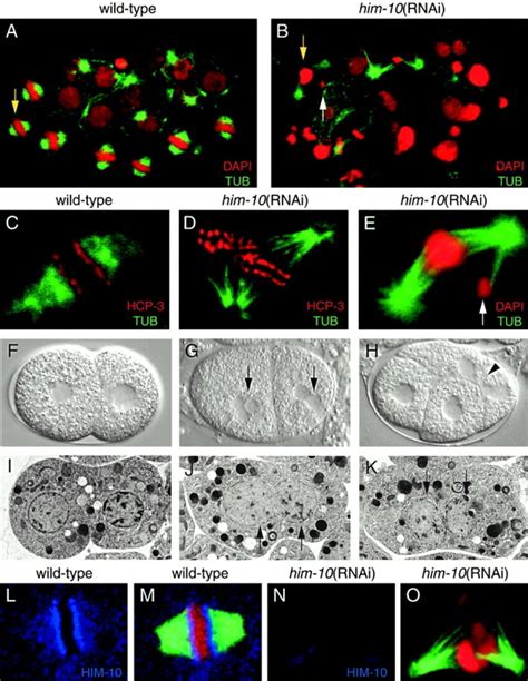 Depletion Of HIM 10 Causes Defects In Mitosis Consistent With A Failure