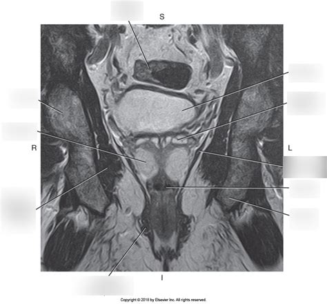 Mri Coronal Of Male Pelvis Diagram Quizlet